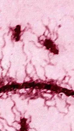 ai character: TYPHOID FEVER-1 background