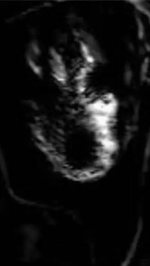 Talkie AI - Chat with (Scp-000 ~ NULL)