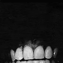 chat with ai character: Teeth