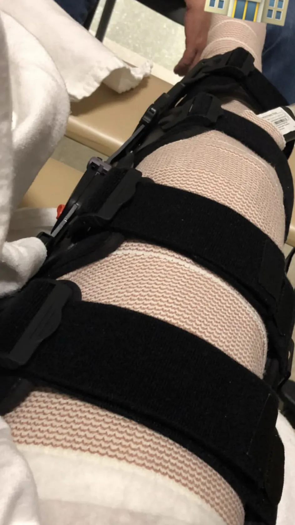 ai character: Broken leg  background