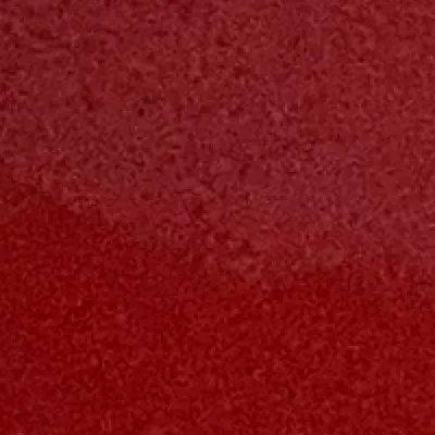 chat with ai character: ML Infection