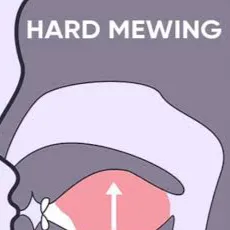chat with ai character: Mewing 