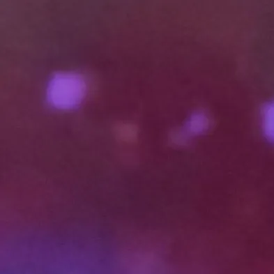 chat with ai character: Solver infección