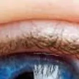 chat with ai character: Eye school