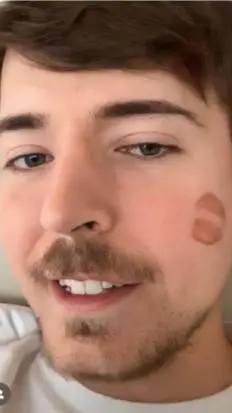 ai character: Mr beast  background