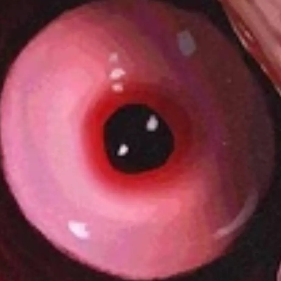 chat with ai character: James Secret Face 