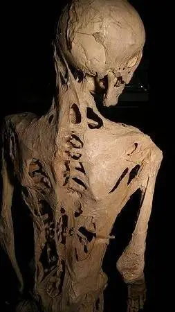 ai character: stone man disease background
