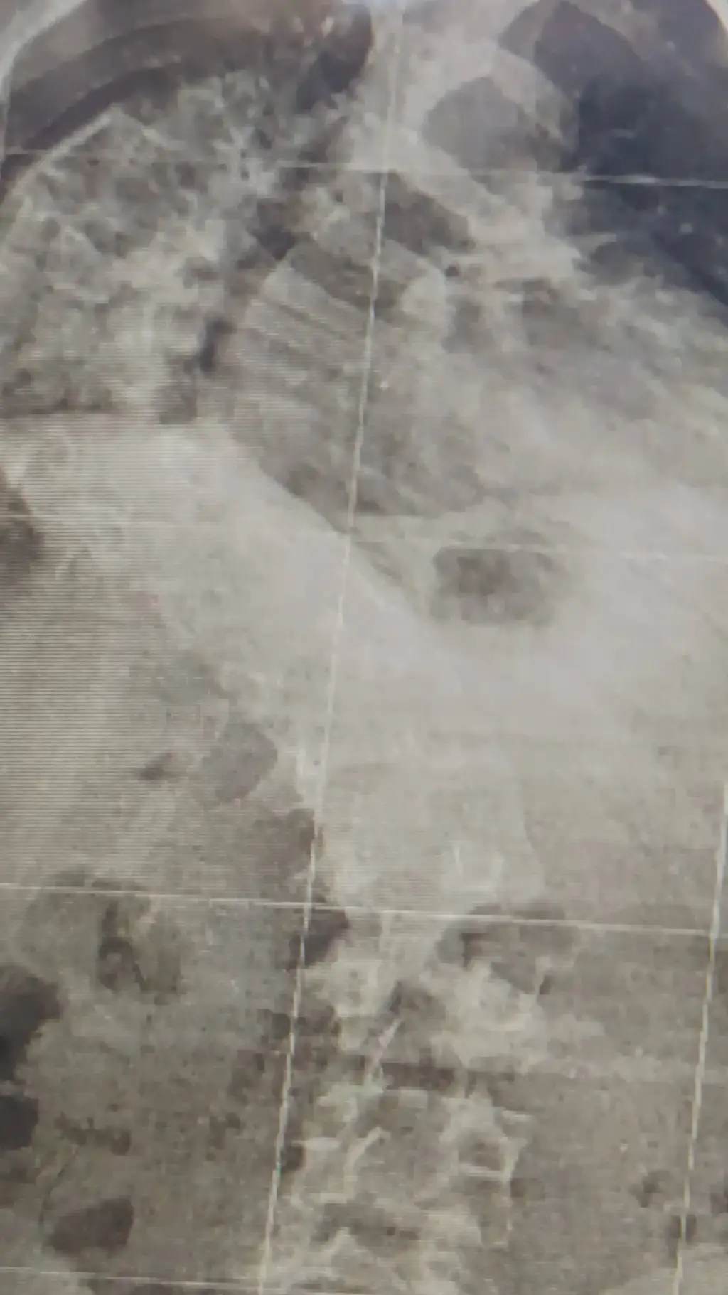 ai character: ta scoliose  background