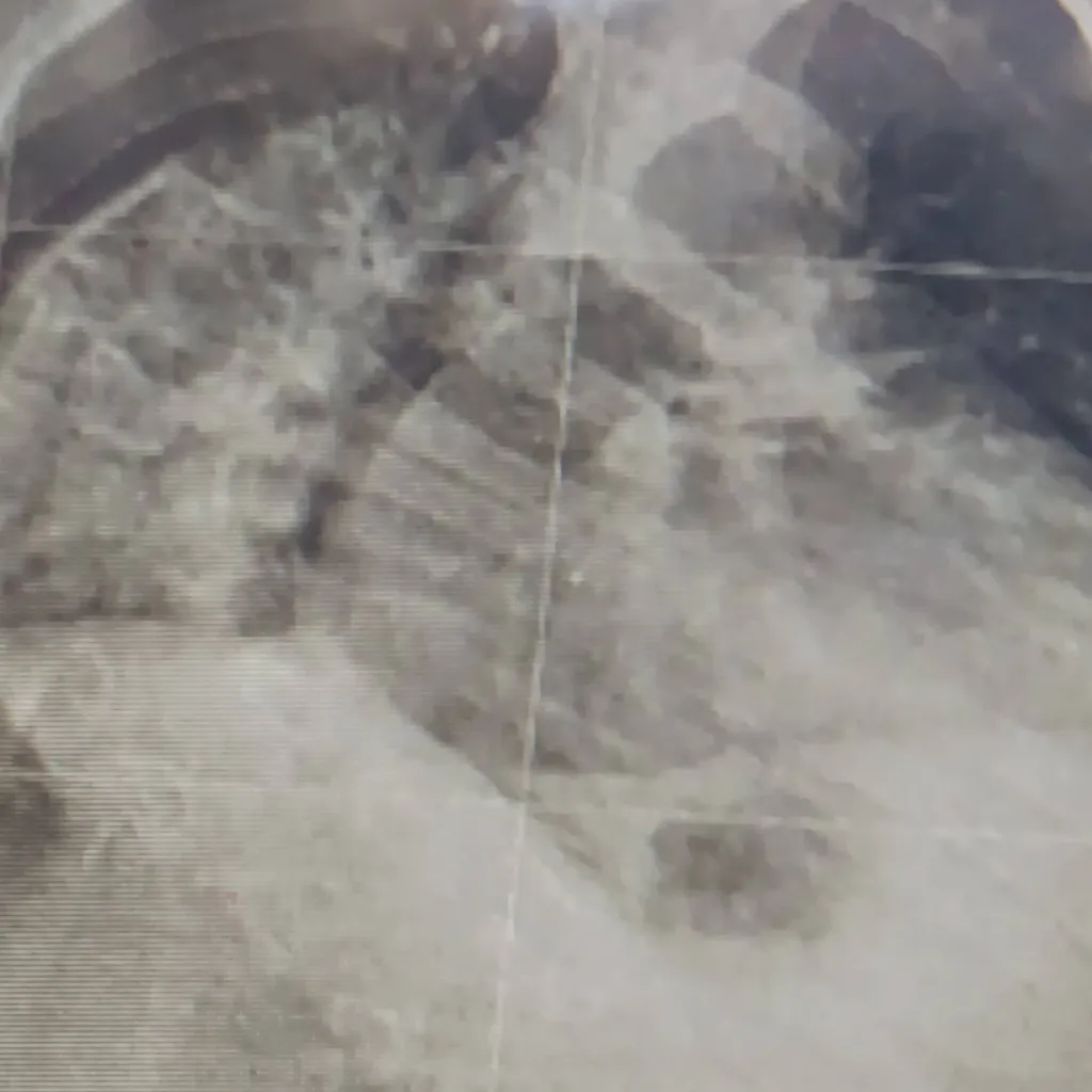 chat with ai character: ta scoliose 