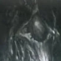 chat with ai character: SCP-939