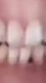 ai character: teeth background