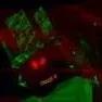 chat with ai character: forsaken infection