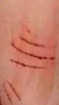 ai character: Scars background