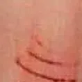 chat with ai character: Scars