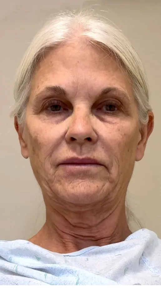 ai character: Patient background