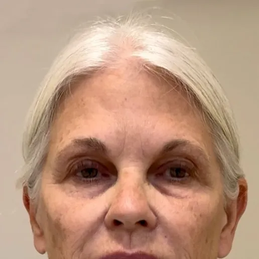 chat with ai character: Patient