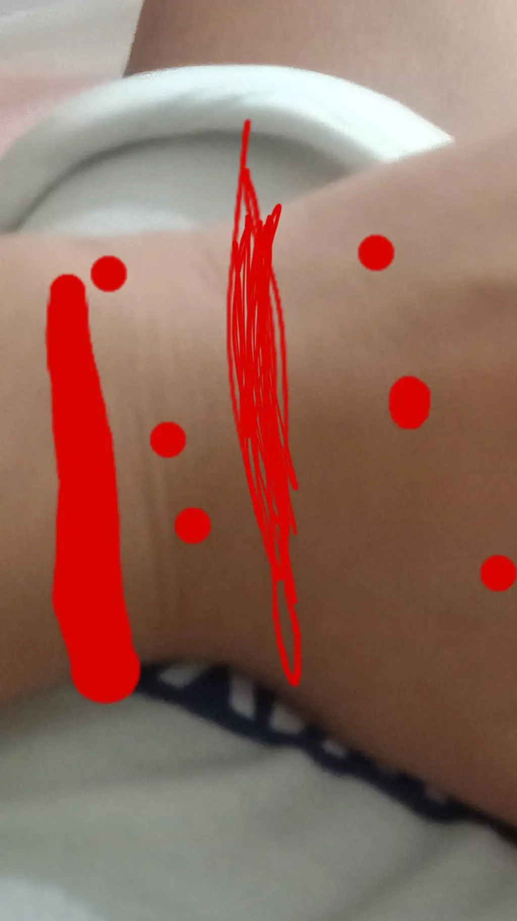 ai character: arm: bleeds background