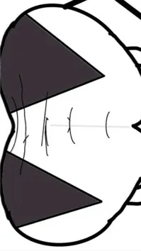 ai character: Implants ￼ background