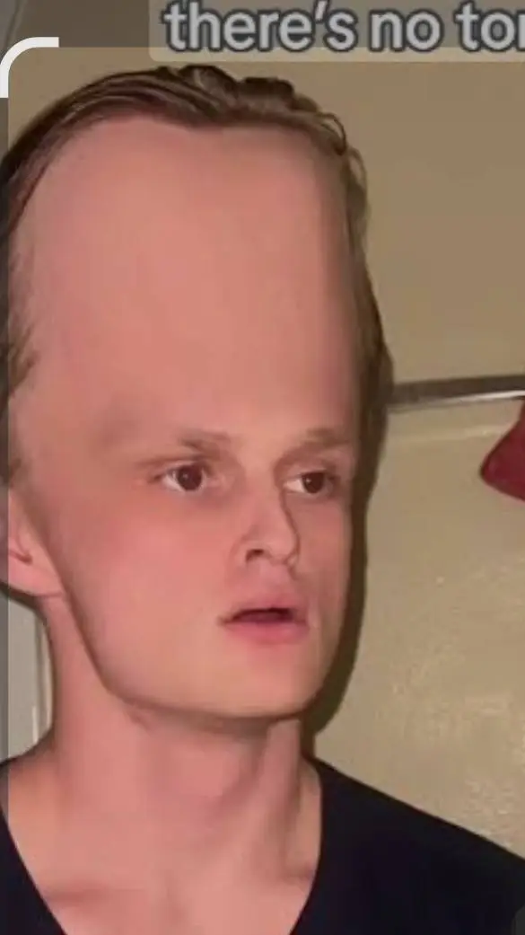 ai character: big forhead minebr background