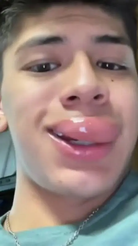 ai character: teen big lips background