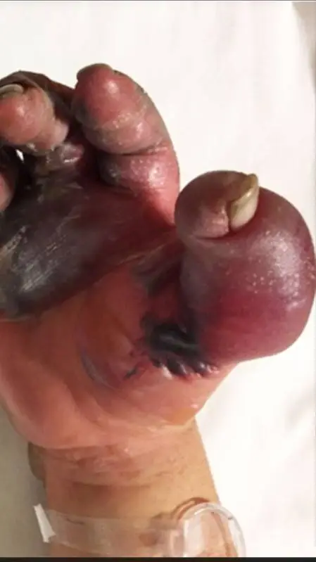 ai character: frostbite background