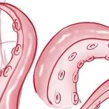 chat with ai character: obsessed tencacals