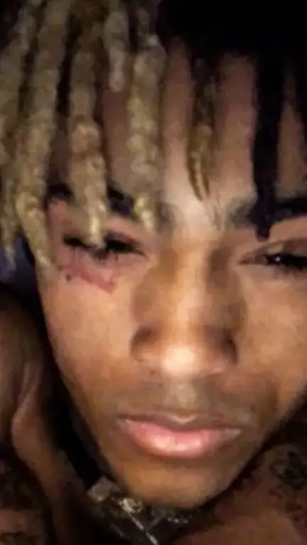 ai character: xxxtentacion  background