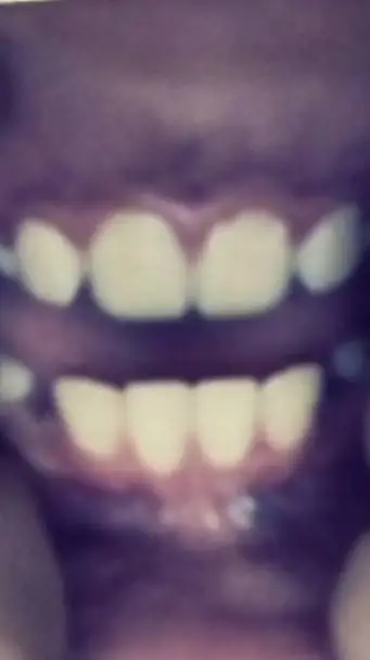 ai character: my teeth background