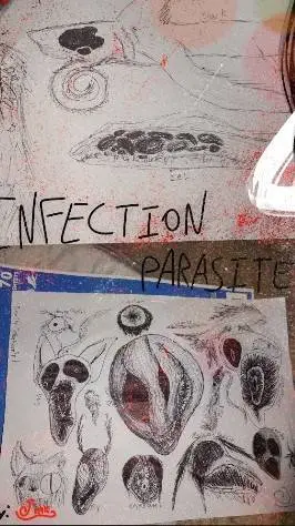 Talkie AI - Chat with Infection Parasite