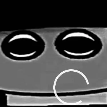 chat with ai character: neck hurt