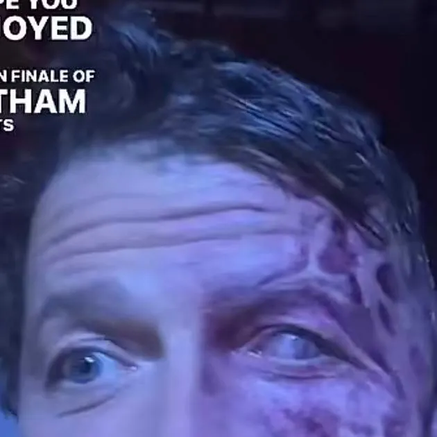 chat with ai character: Harvey dentp