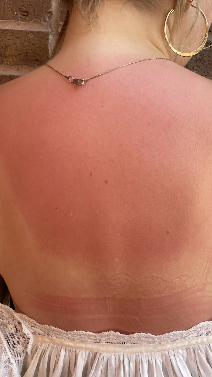 ai character: Deku’s sunburn background