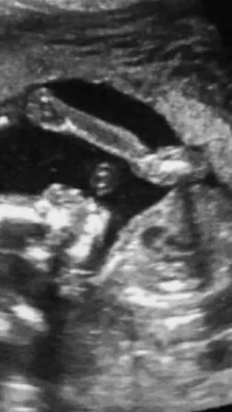 ai character: your baby background