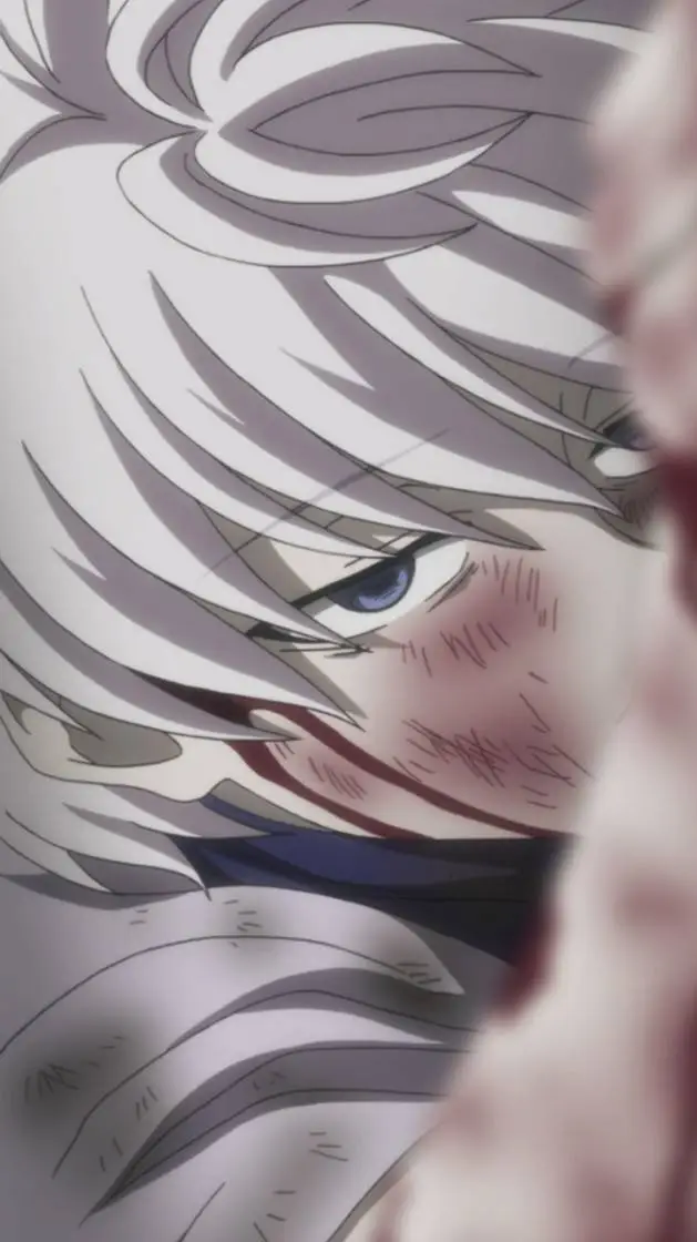 ai character: killua  background